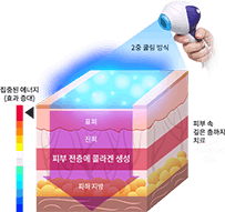 툰페이스 다이어그램